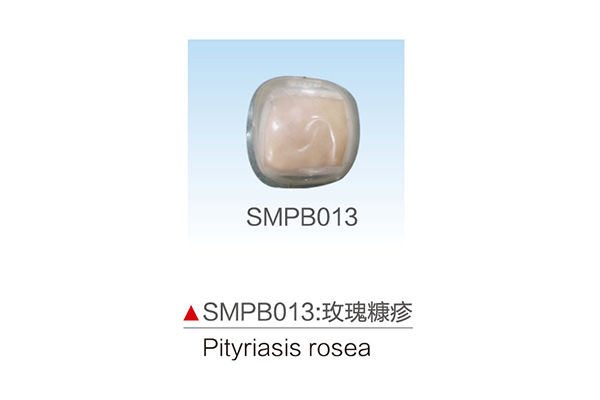 SMPB013    玫瑰糠疹