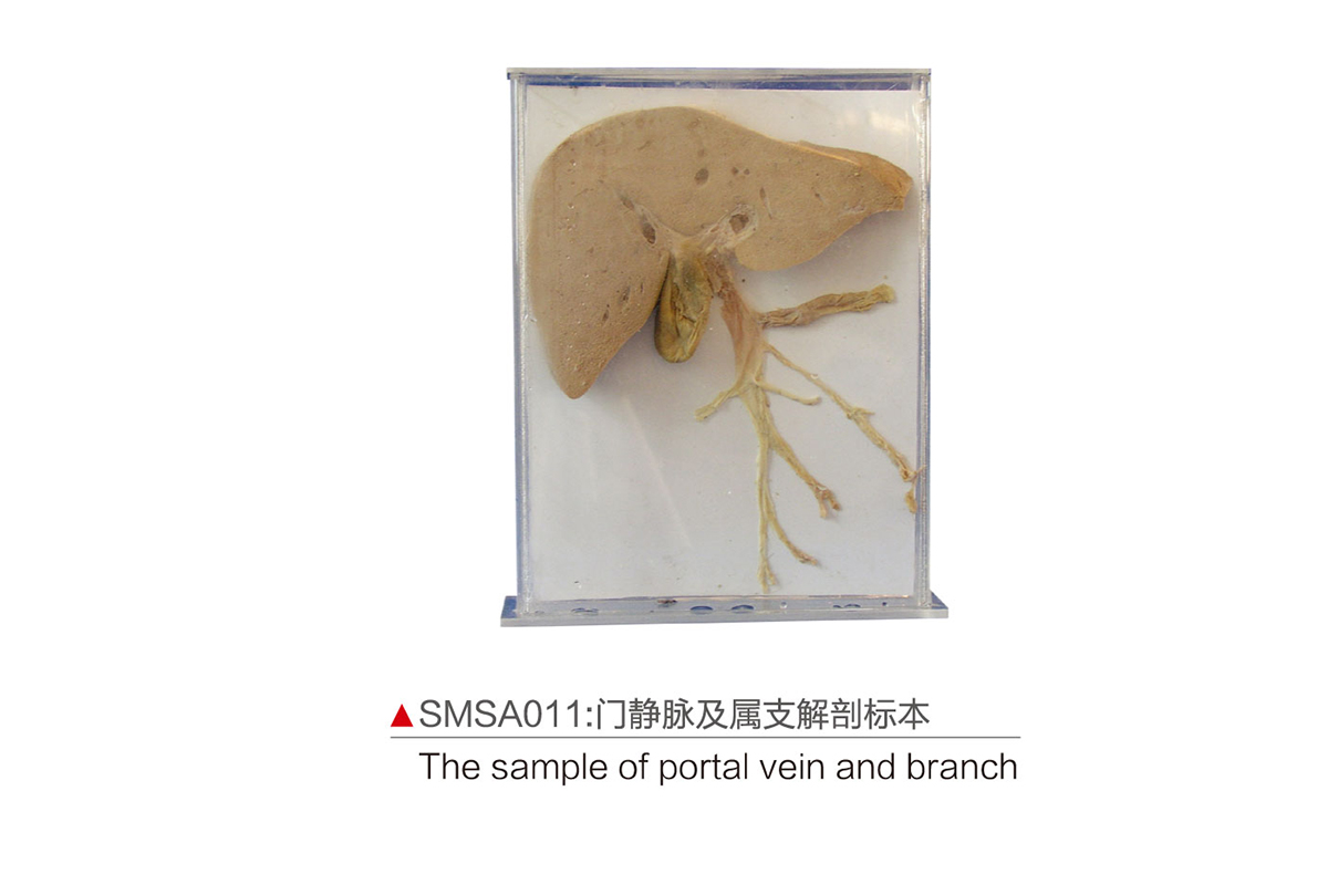 SMSA011：門靜脈及屬支解剖標本
