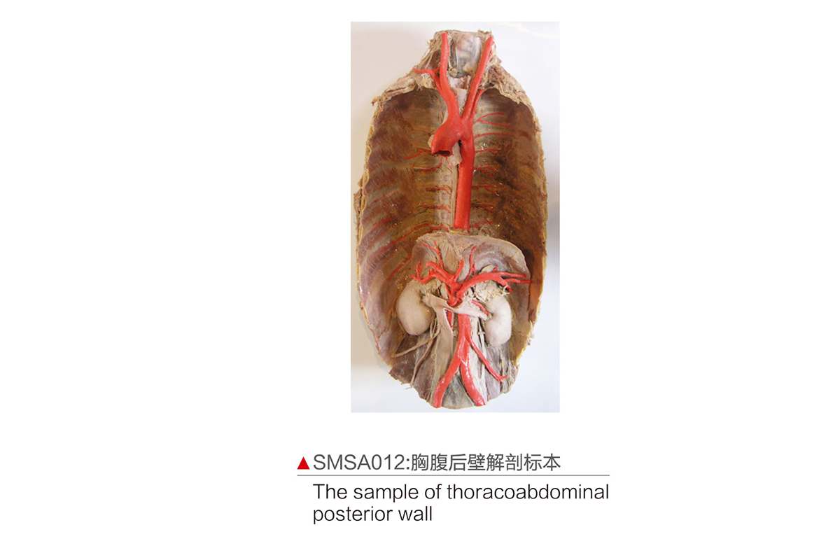 SMSA012：胸腹后壁解剖標本